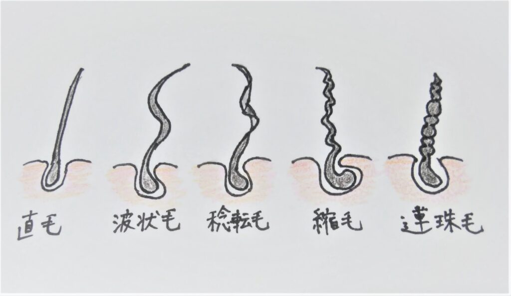 くせ毛の種類／波状毛、捻転毛、縮毛、連珠毛